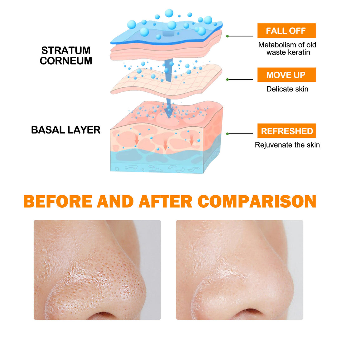 Exfoliating Blackhead Gel Gentle And Tender Skin